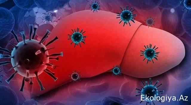 Suraxanı rayonunun 2 böyük qəsəbəsində kütləvi Hepatit" A" virusu yayıldı - QORXUNC HADİSƏ