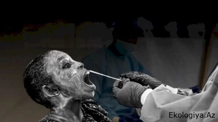 2 gün ərzində öldürən naməlum epidemiya: 50-dən çox insan öldü